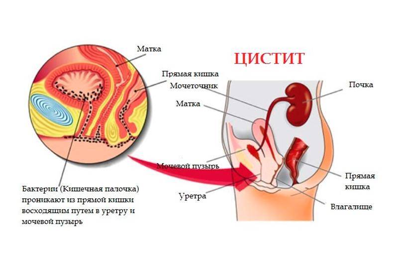 Уретра У Женщин Фото